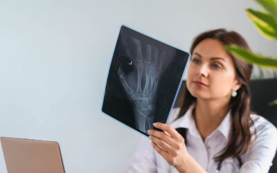 Consejos para Prevenir la Osteoporosis: Mantén Tus Huesos Fuertes de Por Vida